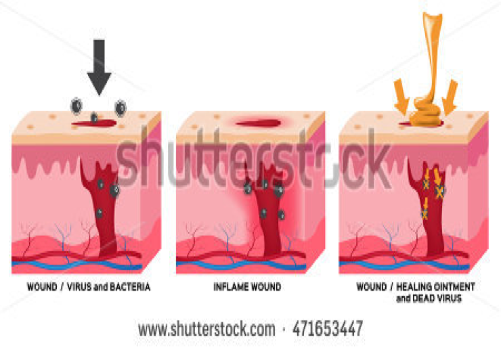 Illustration Illustration