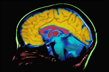 Brain Health